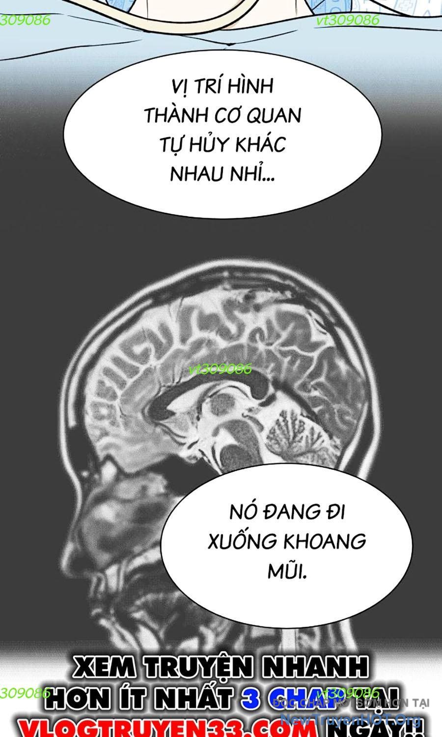 Cơ Quan Tự Hủy Chapter 27 - Trang 2