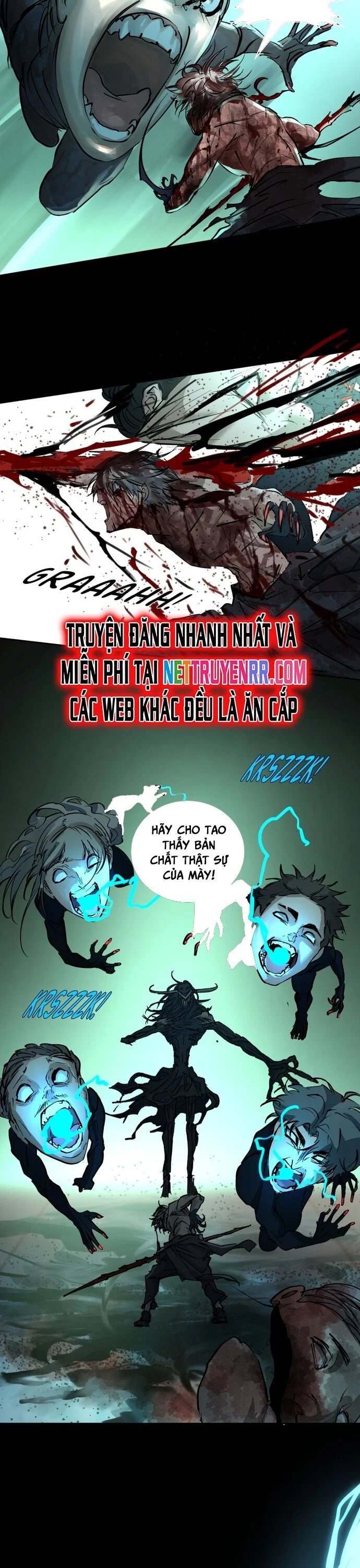 Cột Sống Đỏ Chapter 5 15